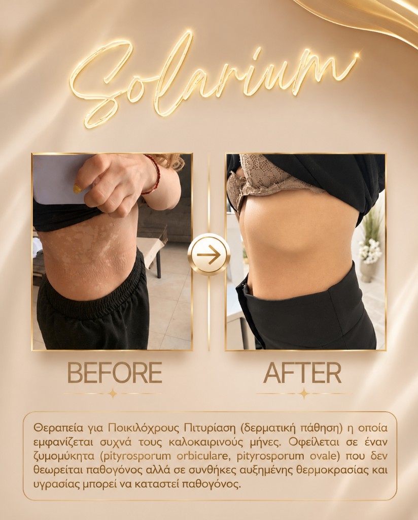 Solarium — ομοιόμορφο μαύρισμα